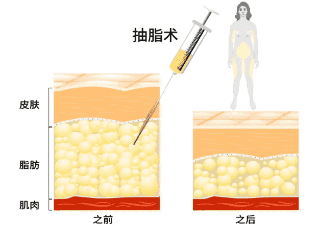 北京雅靓医疗美容整形效果如何？有哪些专业的医生？