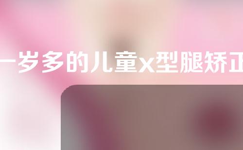 一岁多的儿童x型腿矫正