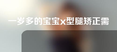 一岁多的宝宝x型腿矫正需要多久