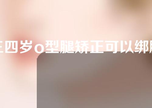 三四岁o型腿矫正可以绑腿吗