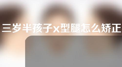 三岁半孩子x型腿怎么矫正