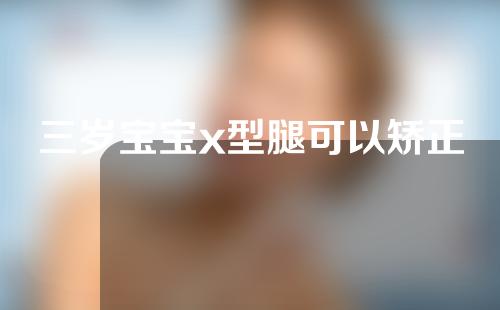 三岁宝宝x型腿可以矫正