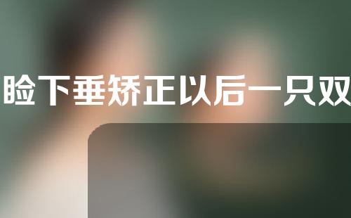 上睑下垂矫正以后一只双眼皮比较宽