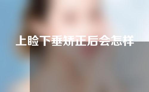 上睑下垂矫正后会怎样