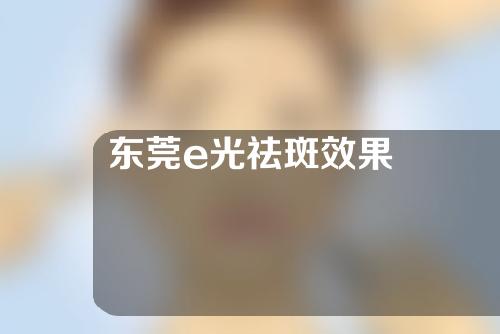 东莞e光祛斑效果