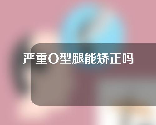 严重O型腿能矫正吗