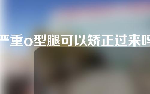 严重o型腿可以矫正过来吗