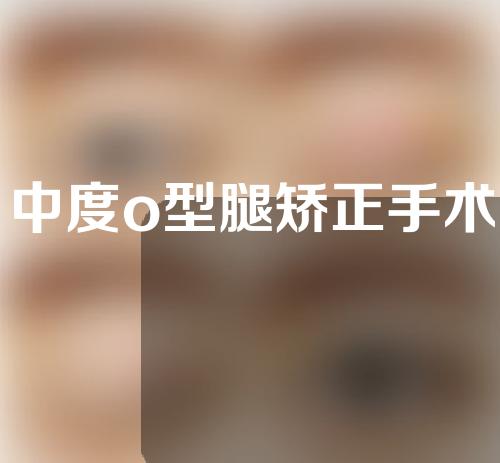 中度o型腿矫正手术