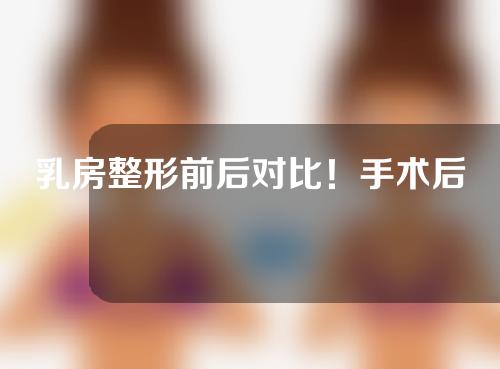 乳房整形前后对比！手术后遗症及治疗措施一览表