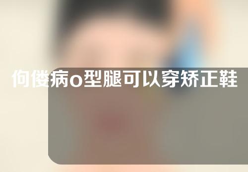 佝偻病o型腿可以穿矫正鞋吗