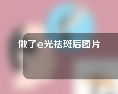 做了e光祛斑后图片