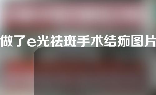 做了e光祛斑手术结痂图片