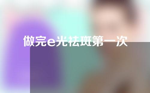 做完e光祛斑第一次