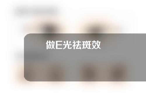 做E光祛斑效