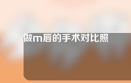 做m唇的手术对比照