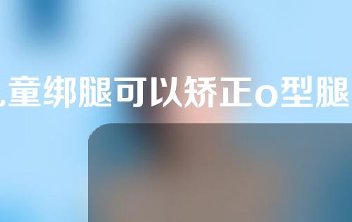 儿童绑腿可以矫正o型腿吗