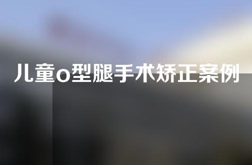 儿童o型腿手术矫正案例