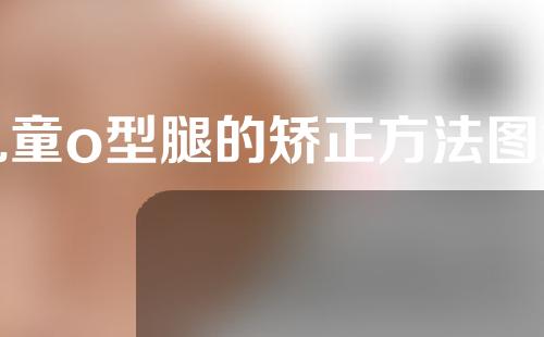 儿童o型腿的矫正方法图解