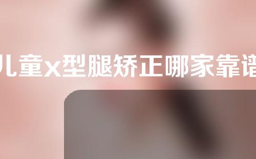 儿童x型腿矫正哪家靠谱