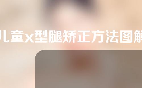 儿童x型腿矫正方法图解