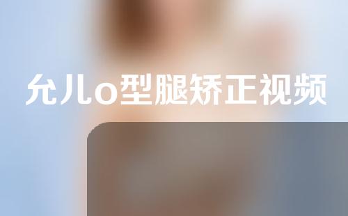 允儿o型腿矫正视频