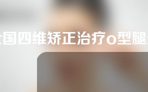 全国四维矫正治疗o型腿最好医院