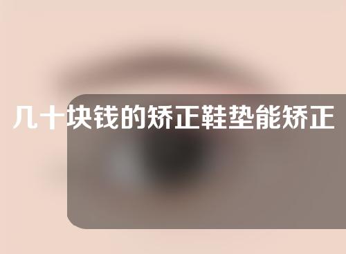 几十块钱的矫正鞋垫能矫正x型腿吗