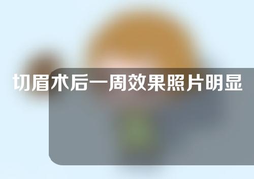 切眉术后一周效果照片明显吗？切眉术几岁做比较好？