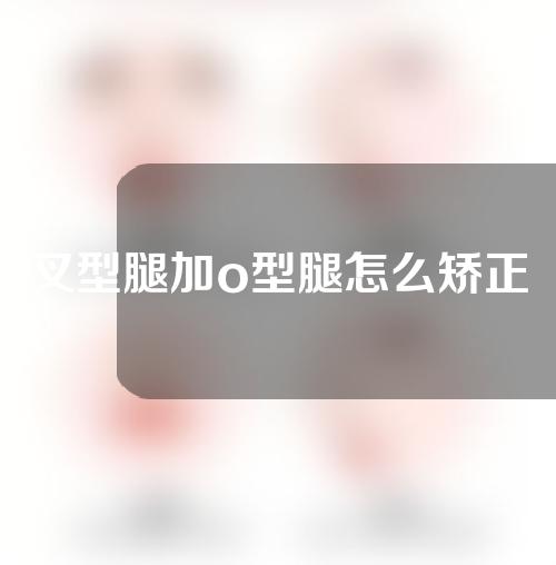 叉型腿加o型腿怎么矫正