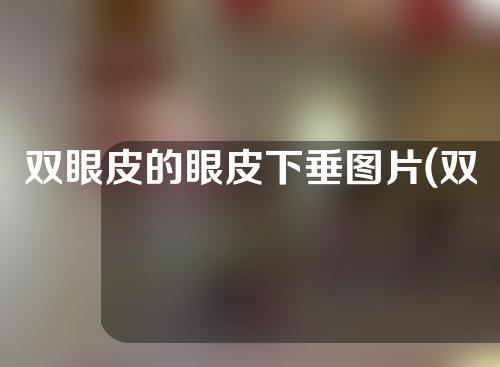 双眼皮的眼皮下垂图片(双眼皮的眼皮下垂图片女)