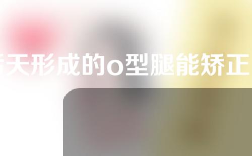 后天形成的o型腿能矫正吗