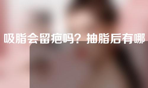 吸脂会留疤吗？抽脂后有哪些注意事项？