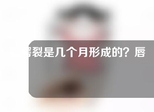 唇腭裂是几个月形成的？唇腭裂要怎么治疗？