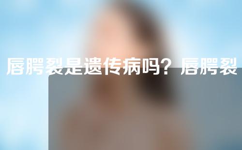 唇腭裂是遗传病吗？唇腭裂是染色体异常吗？