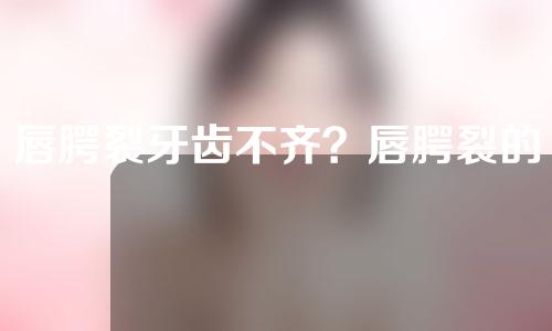 唇腭裂牙齿不齐？唇腭裂的孩子智力有问题吗？