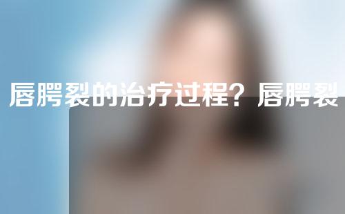 唇腭裂的治疗过程？唇腭裂的孩子到底生不生？