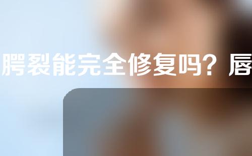 唇腭裂能完全修复吗？唇腭裂能免费治疗吗？