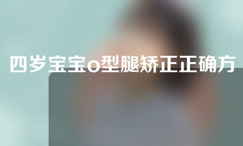 四岁宝宝o型腿矫正正确方法