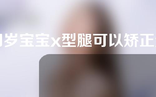 四岁宝宝x型腿可以矫正过来吗
