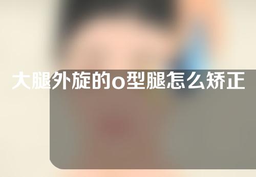 大腿外旋的o型腿怎么矫正