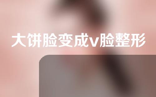 大饼脸变成v脸整形