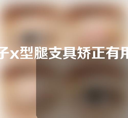 孩子x型腿支具矫正有用吗