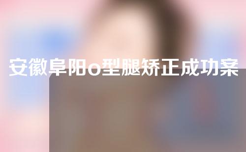 安徽阜阳o型腿矫正成功案例