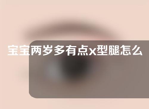 宝宝两岁多有点x型腿怎么矫正