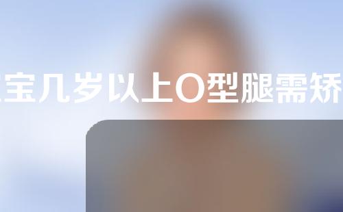 宝宝几岁以上O型腿需矫正