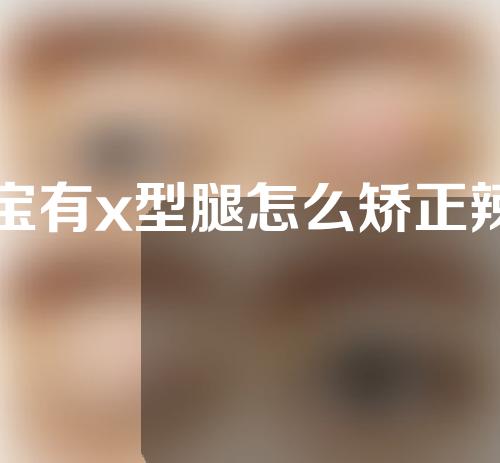 宝宝有x型腿怎么矫正辣妈帮