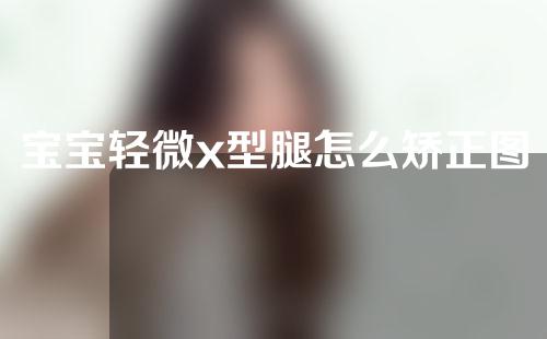 宝宝轻微x型腿怎么矫正图解