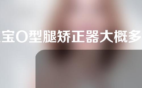 宝宝O型腿矫正器大概多少钱