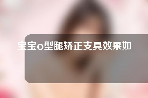 宝宝o型腿矫正支具效果如何