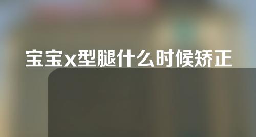 宝宝x型腿什么时候矫正